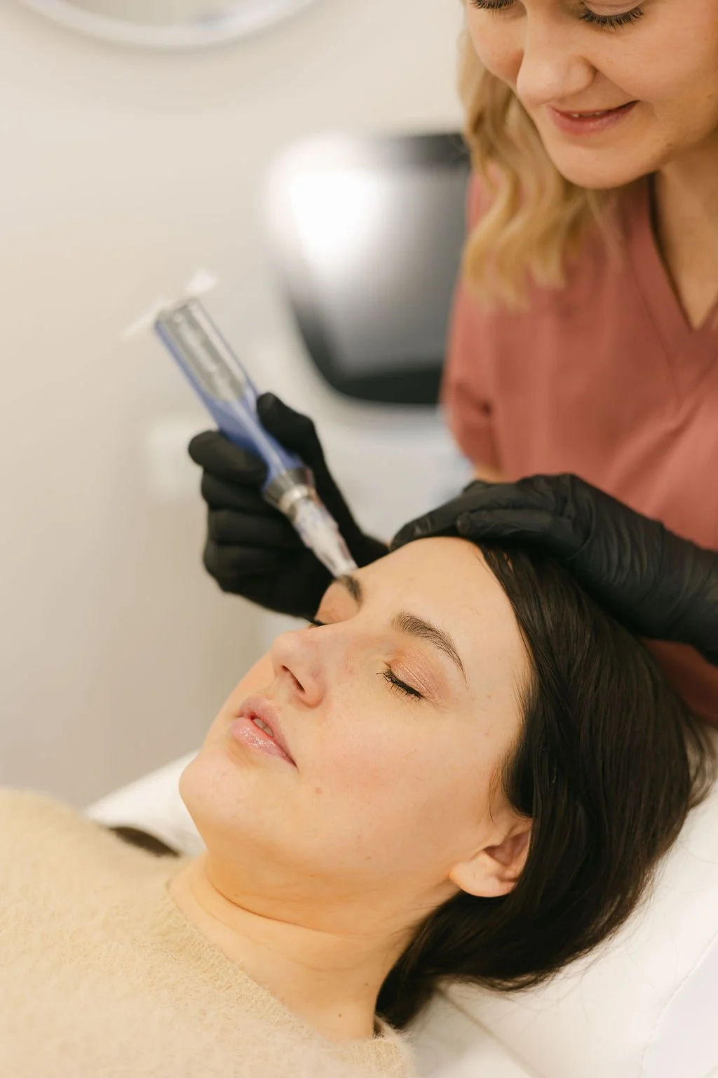 Microneedling Mapperley - skinpen microneedling treatment carried out on a ladies face by a skilled practitioner in a Nottingham clinic.