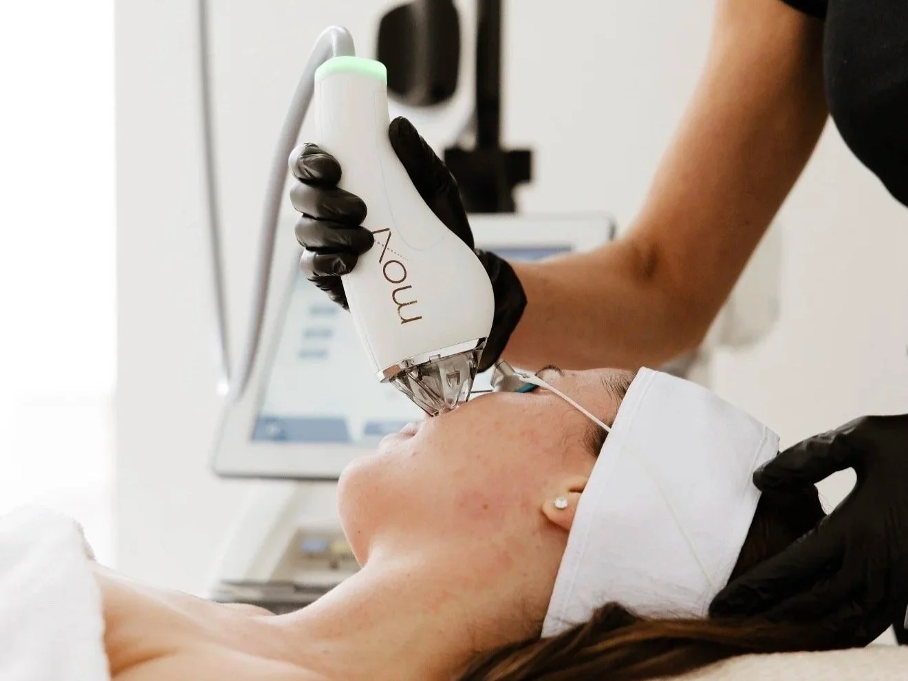 Moxi and BBL treatment using the specialist equipment in a professional aesthetics clinic