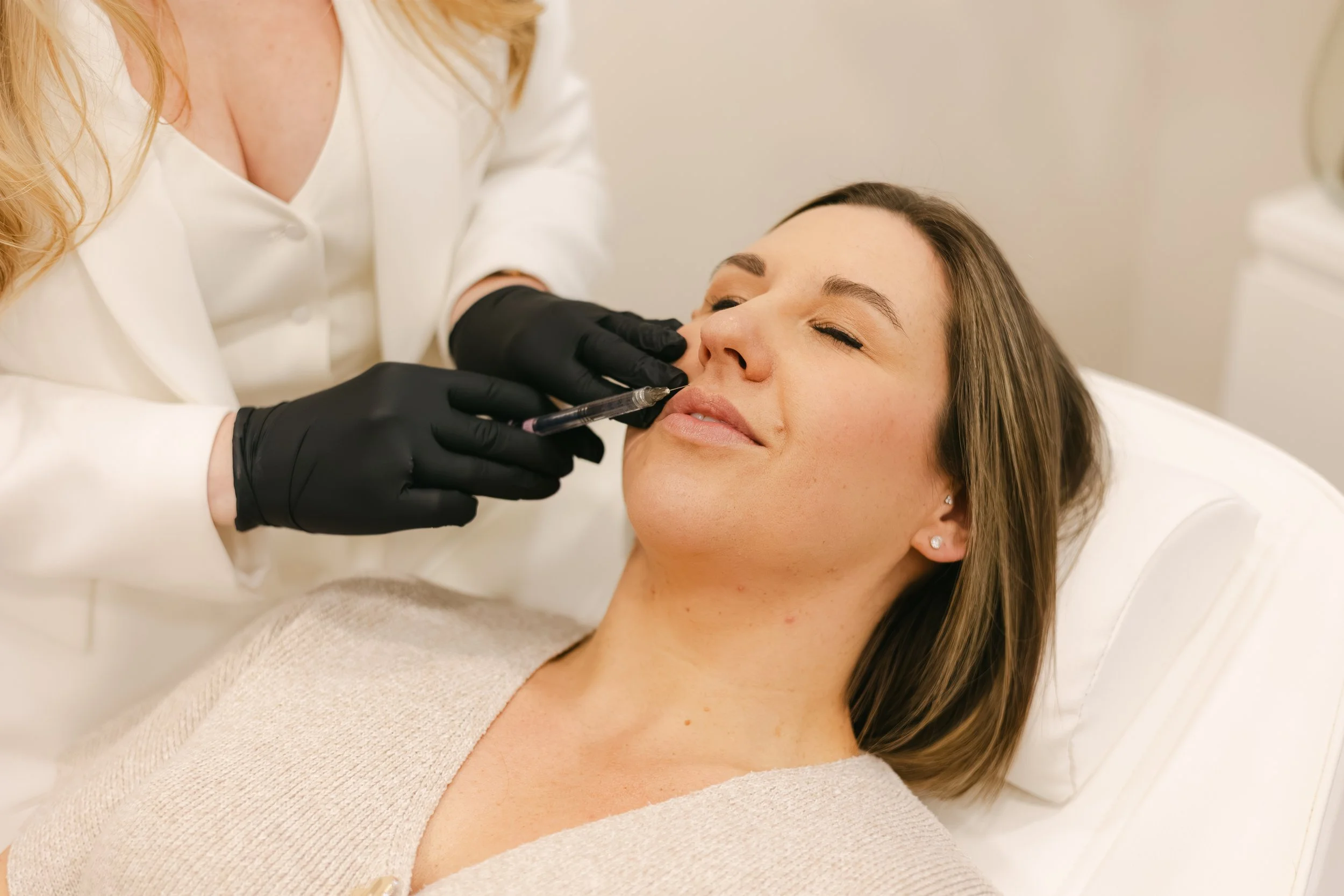 nasolabial fold filler nottingham