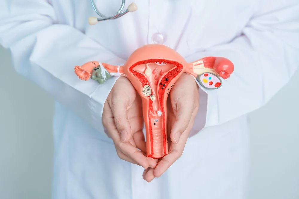 Doctor holding a model of the female reproductive system, symbolizing Polycystic Ovary Syndrome (PCOS), hormonal imbalance, and reproductive health challenges in women.