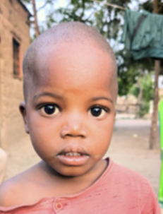 Close-up of a young child with a shaved head, wearing a pink shirt, outdoors in a rural setting.