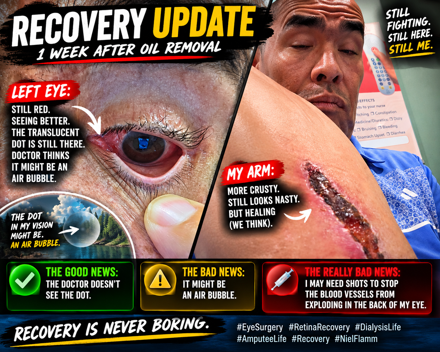 Recovery Update: The Bubble, the Blood Vessels &amp; the Crusty Arm