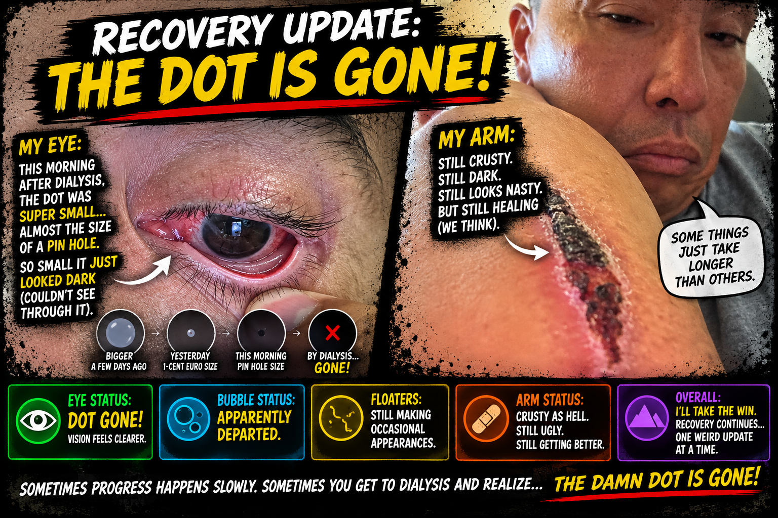 Recovery Update: THE DOT IS GONE! 👁️🎉