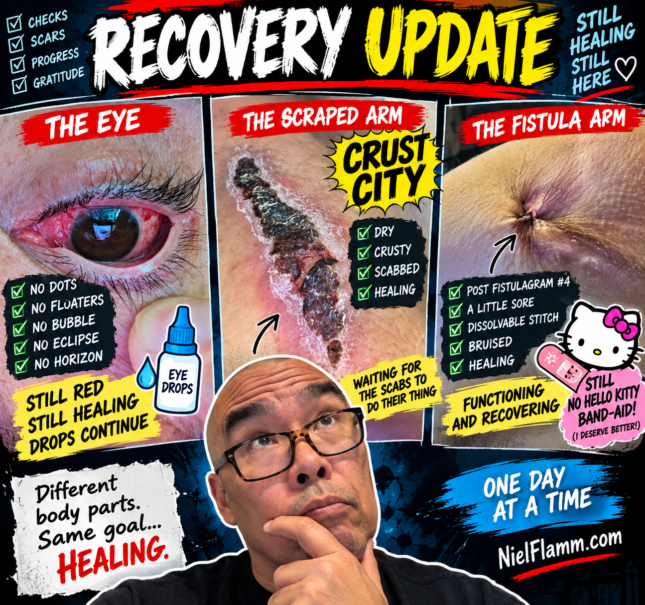 Recovery Update: Three Body Parts, Three Different Definitions of “Healing”