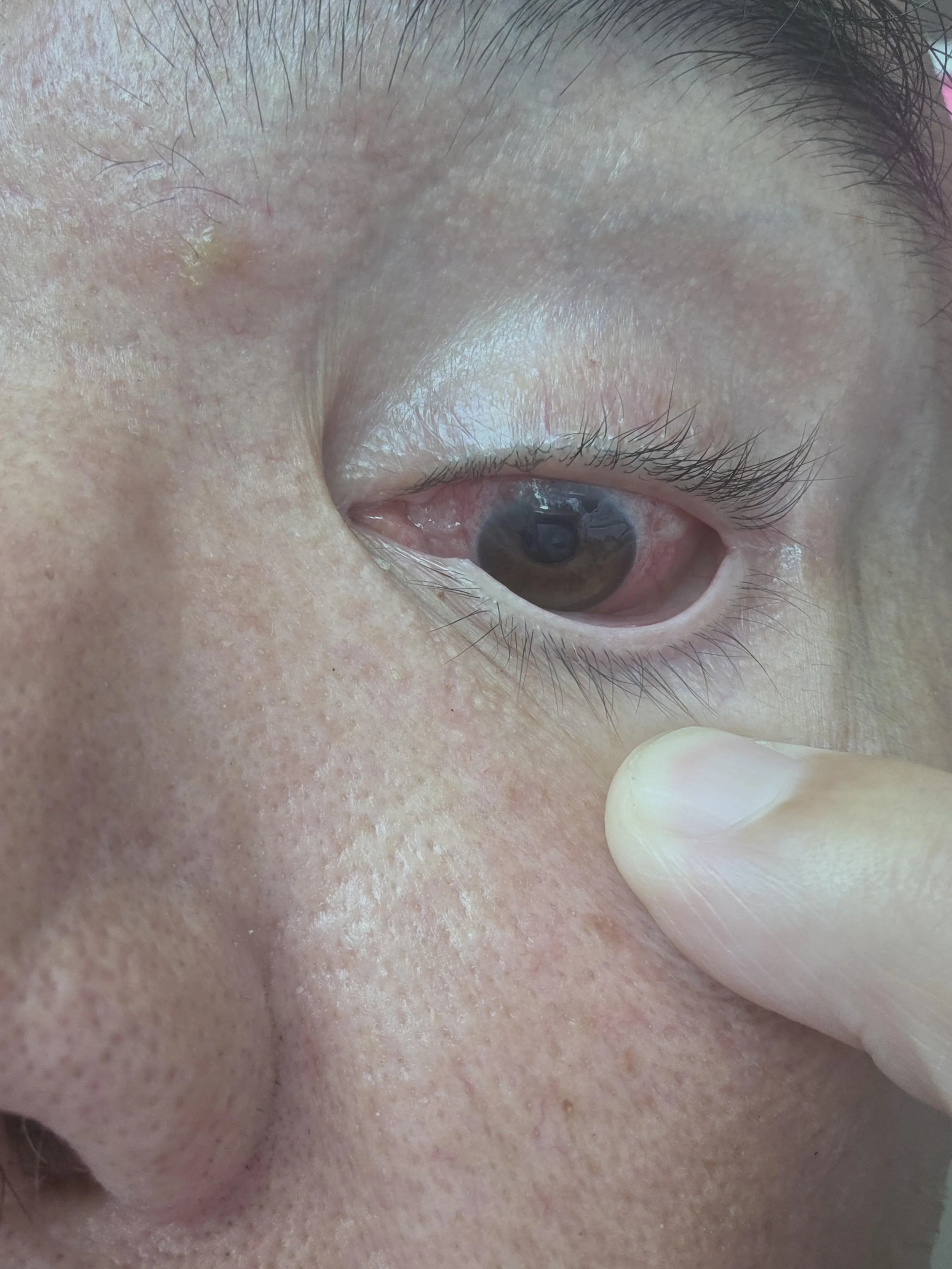 Great News From the Retina Doctor: It’s Attached!