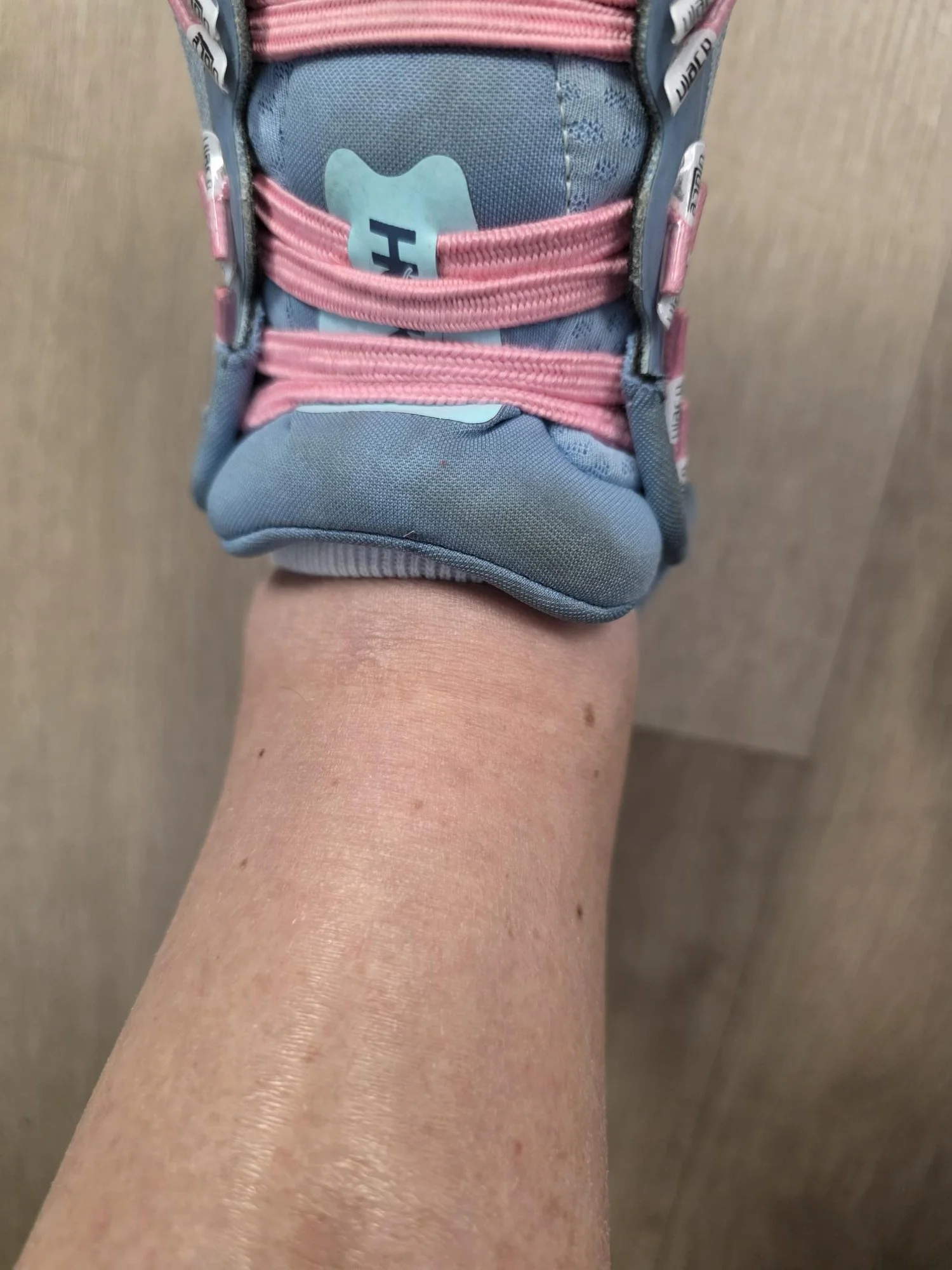The Ankle Report: My Low-Tech Fluid Monitoring System