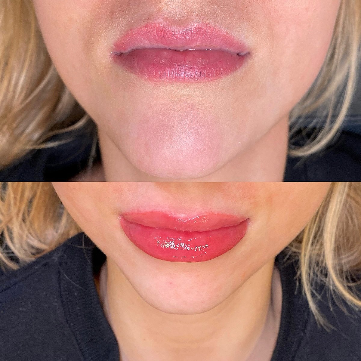 ✨ 2026 New Year&rsquo;s Resolution ✨
It&rsquo;s time to ditch the lip tint, stain, and constant reapplying of lip gloss&mdash;and make the jump to lip blushing 💋

What is lip blushing?
Lip blushing is a semi-permanent cosmetic tattoo that enhances y