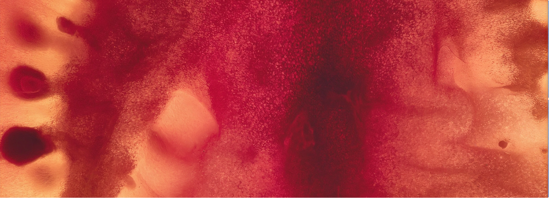 postpartum hemorrhage