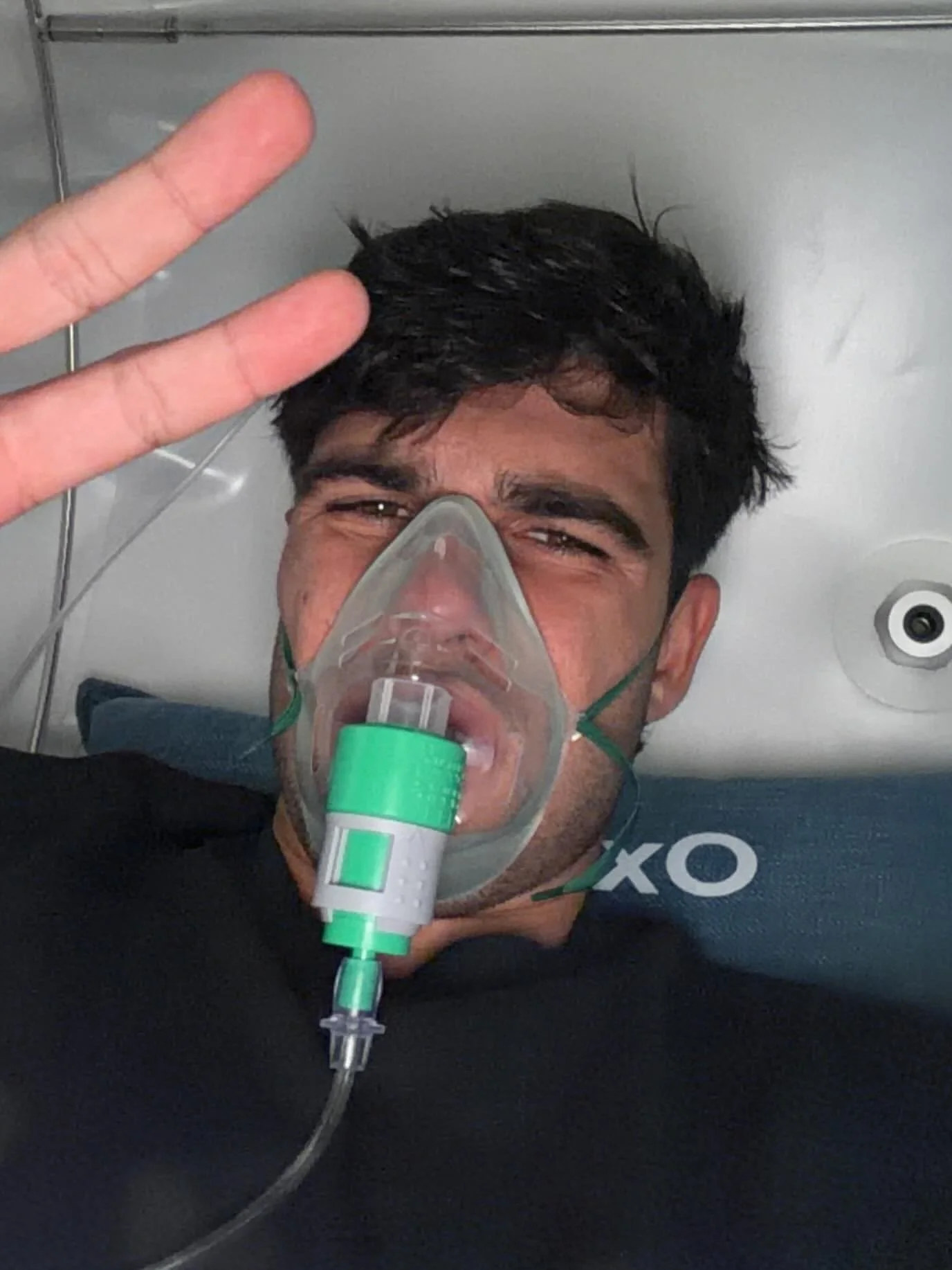 Hyperbaric Oxygen