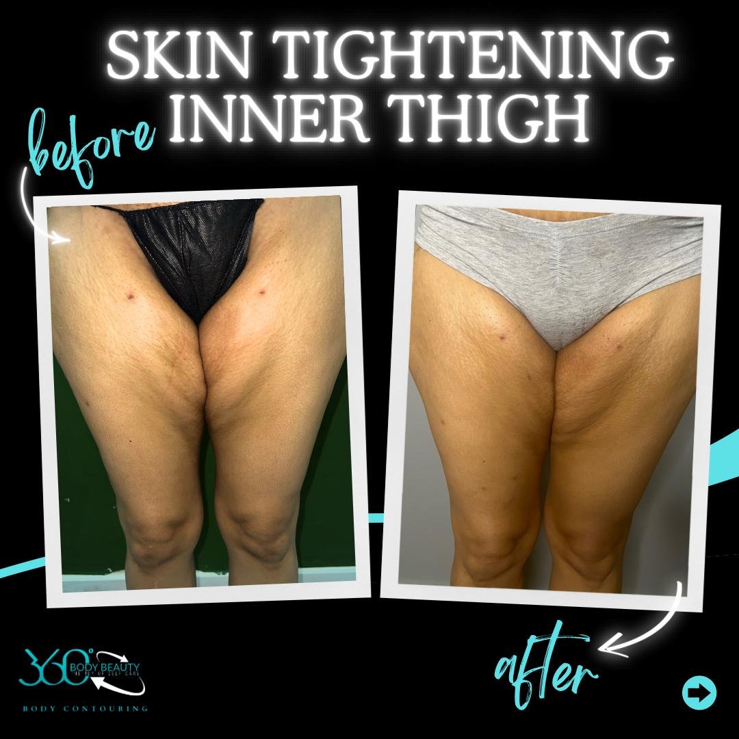 WhatsApp Image 2025-04-10 at 20.58.27 (5).jpeg