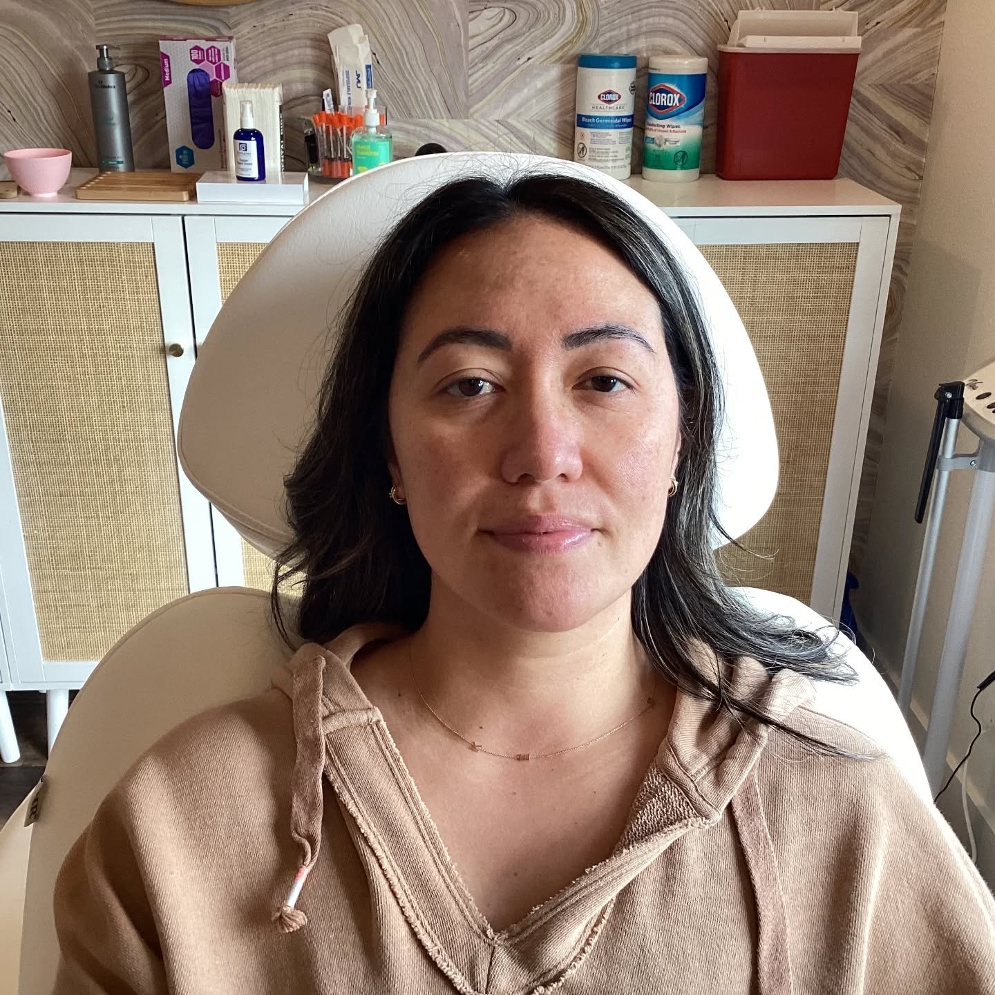 ✨Glow up underway....
My gorgeous client had a microneedling treatment. There are several reasons why microneedling is 🔥 

⚡diminished pore size
⚡fewer wrinkles
⚡tightens skin
⚡lightens scaring
⚡evens out skin tone

These pictures show before and im