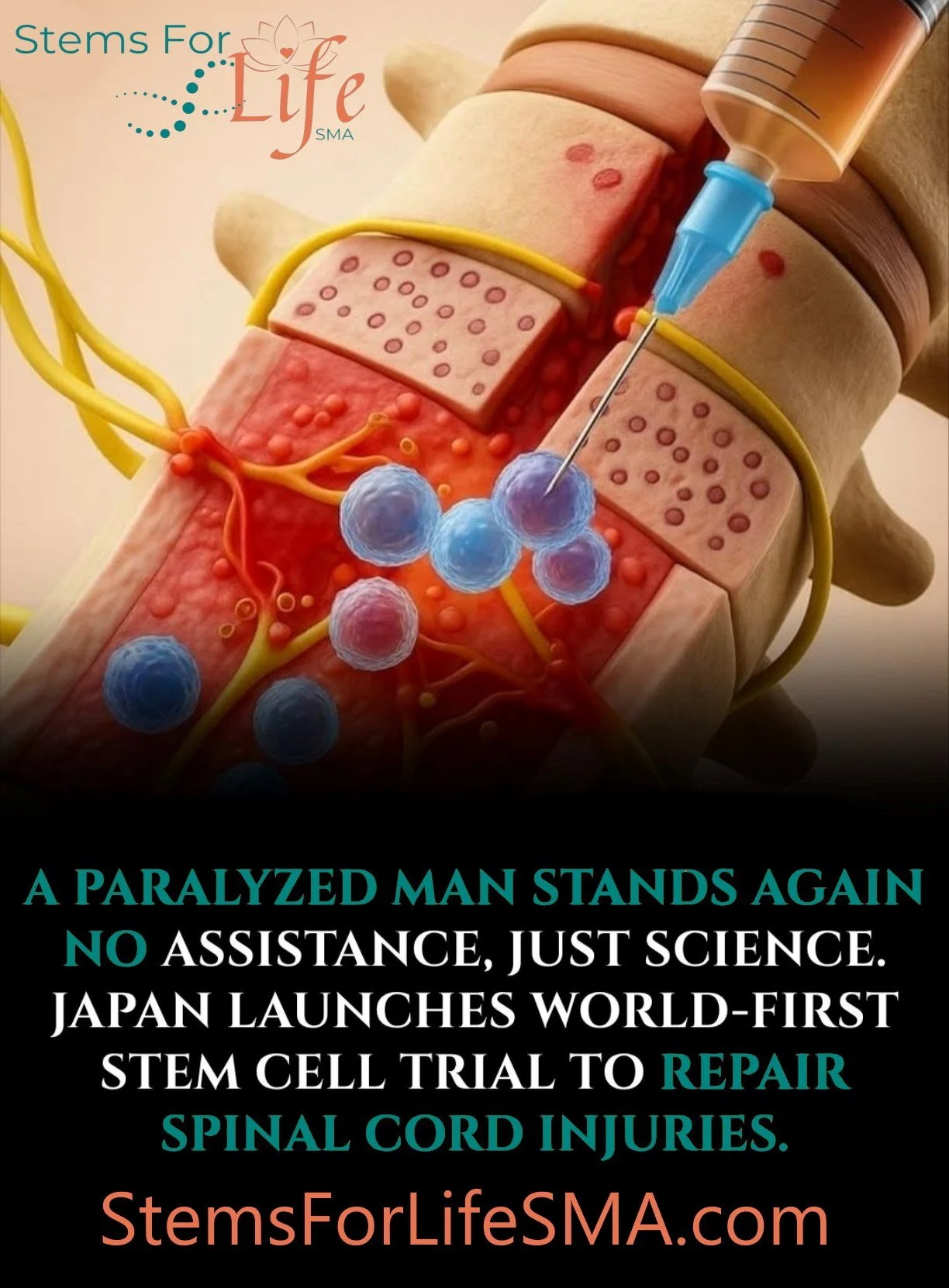 Stem Cells Restoring Mobility: Breakthroughs in Spinal Cord Recovery