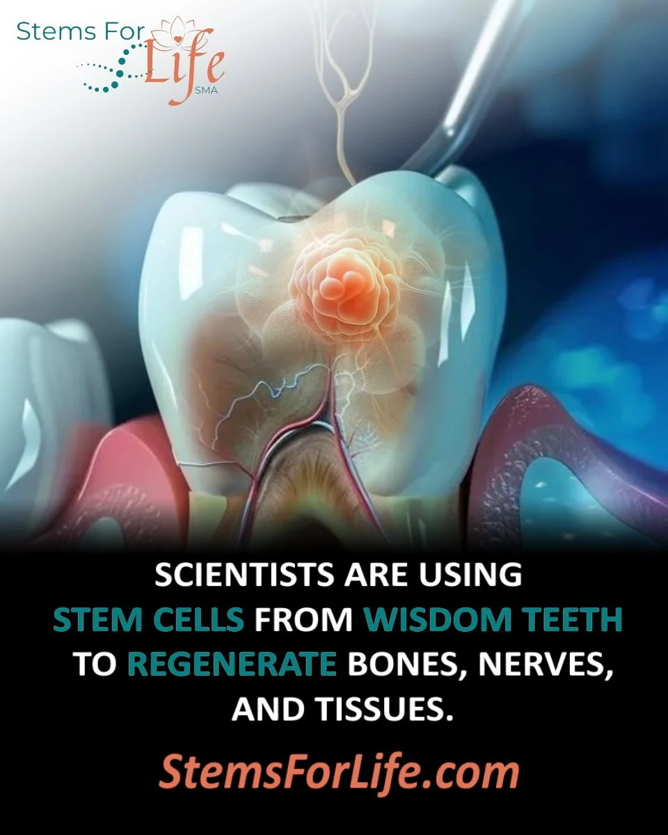 Unlocking the Hidden Power of Wisdom Teeth: Dental Pulp Stem Cells