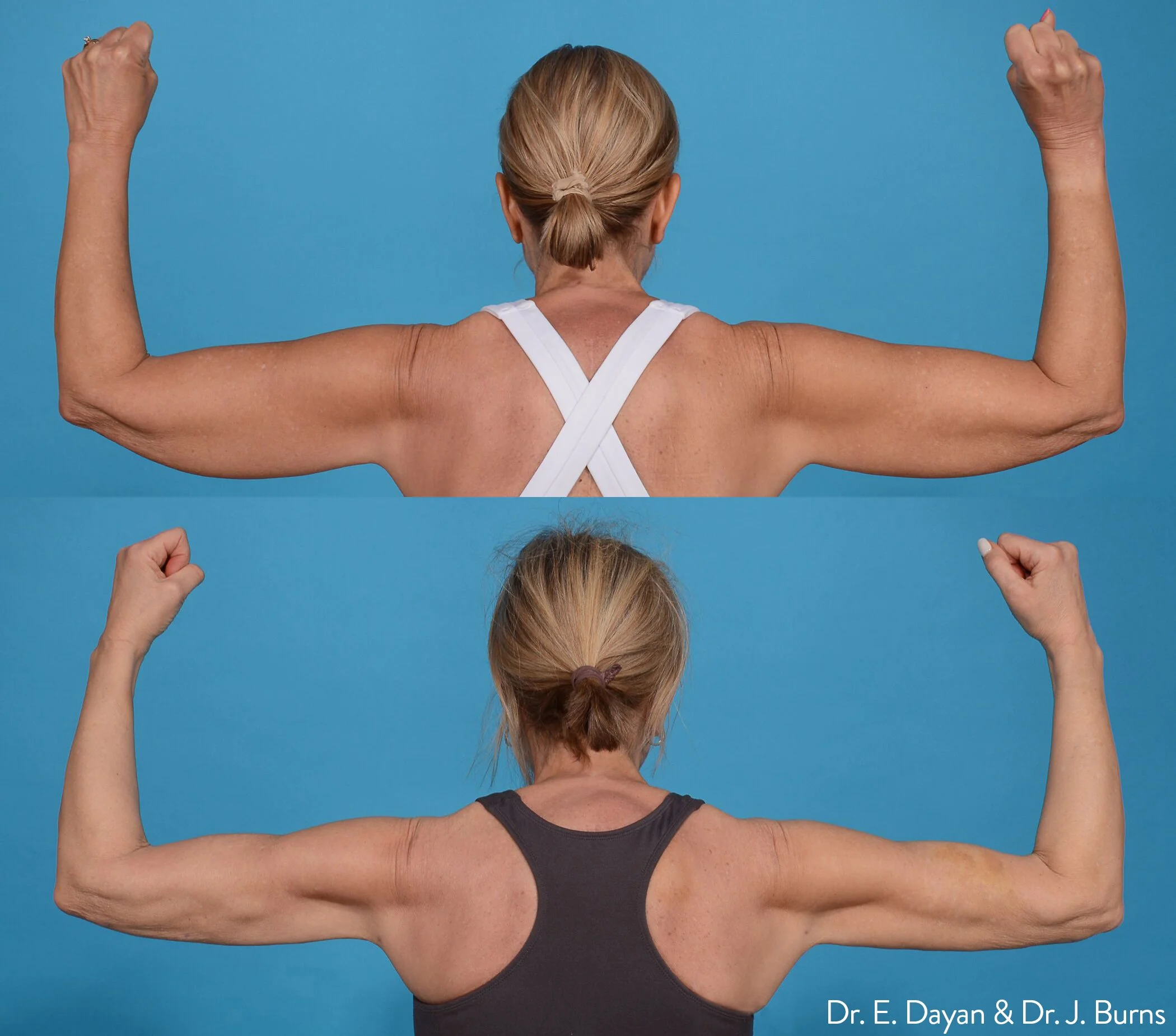 Photos courtesy of InMode.