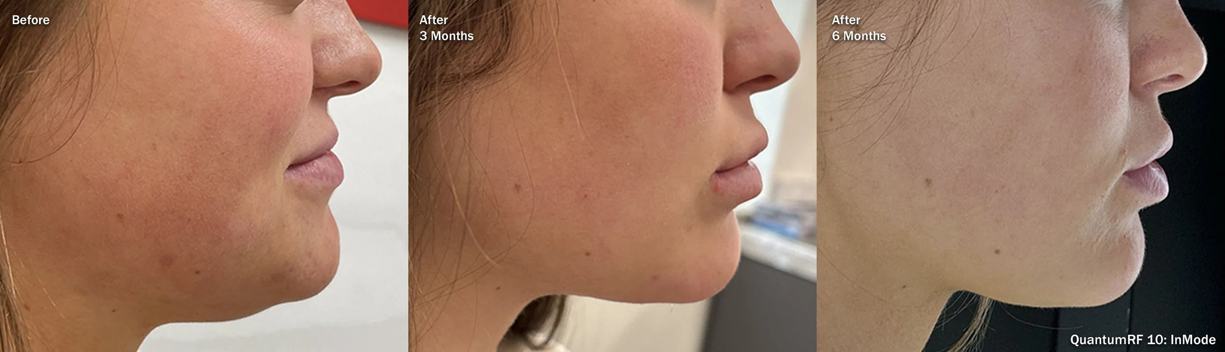Photos courtesy of InMode.