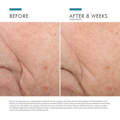 Triple-Lipid-Restore-3606000434967-SkinCeuticals6.jpg