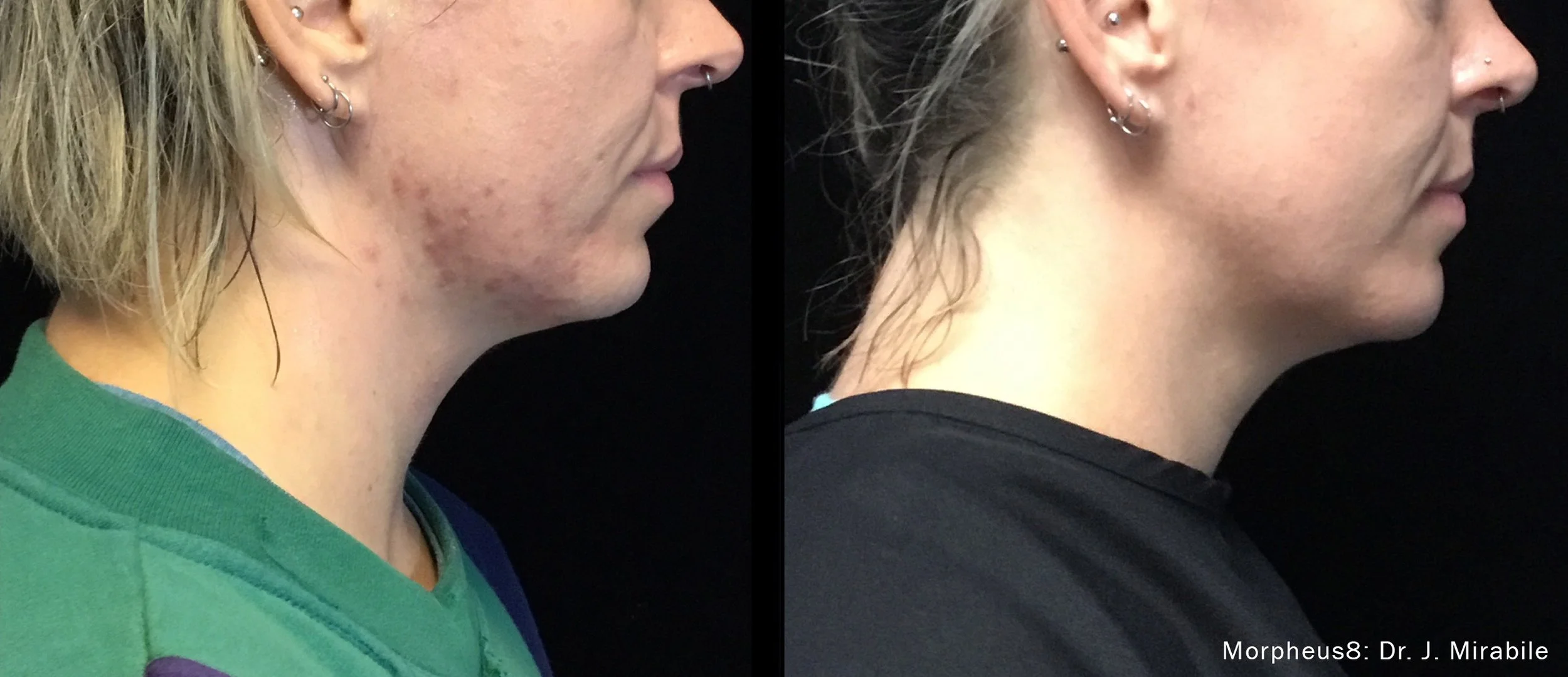 Photos courtesy of InMode.