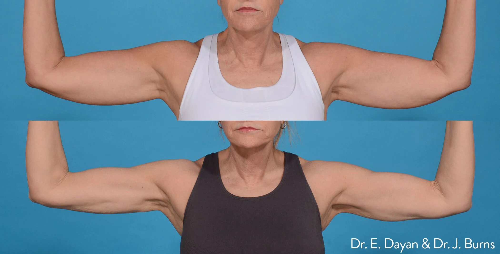 Photos courtesy of InMode.