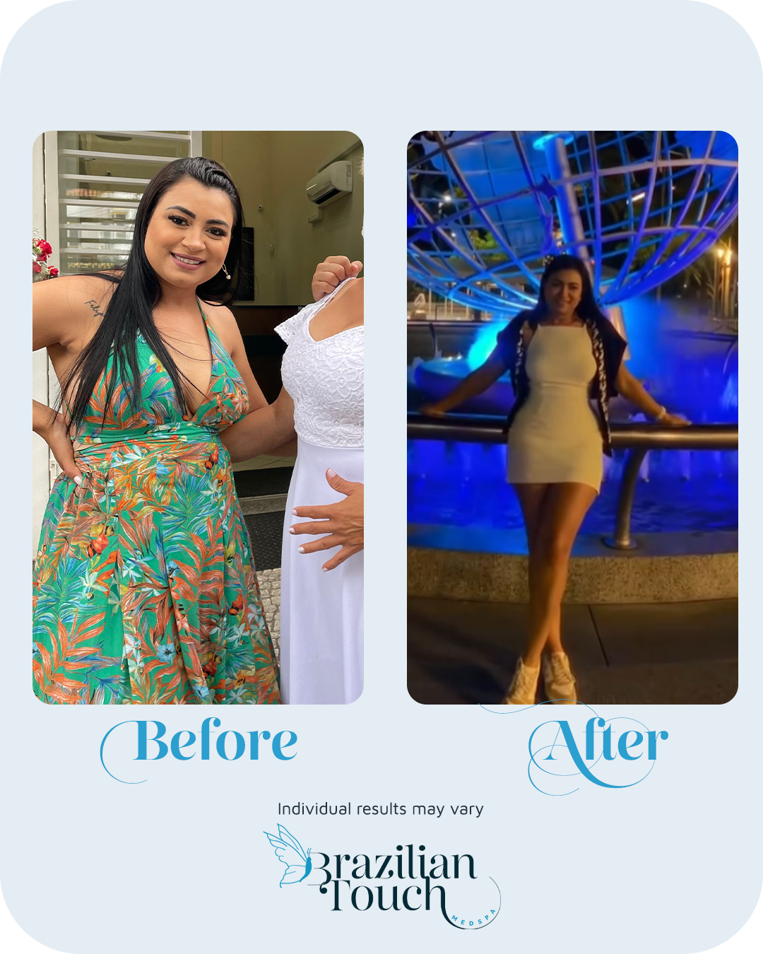before-after-weight-loss-patient-brazilian-touch05.png
