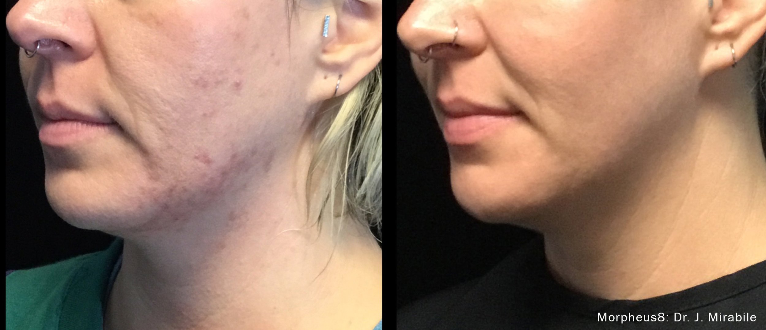 Photos courtesy of InMode.