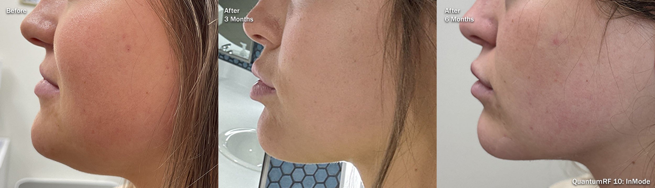 Photos courtesy of InMode.