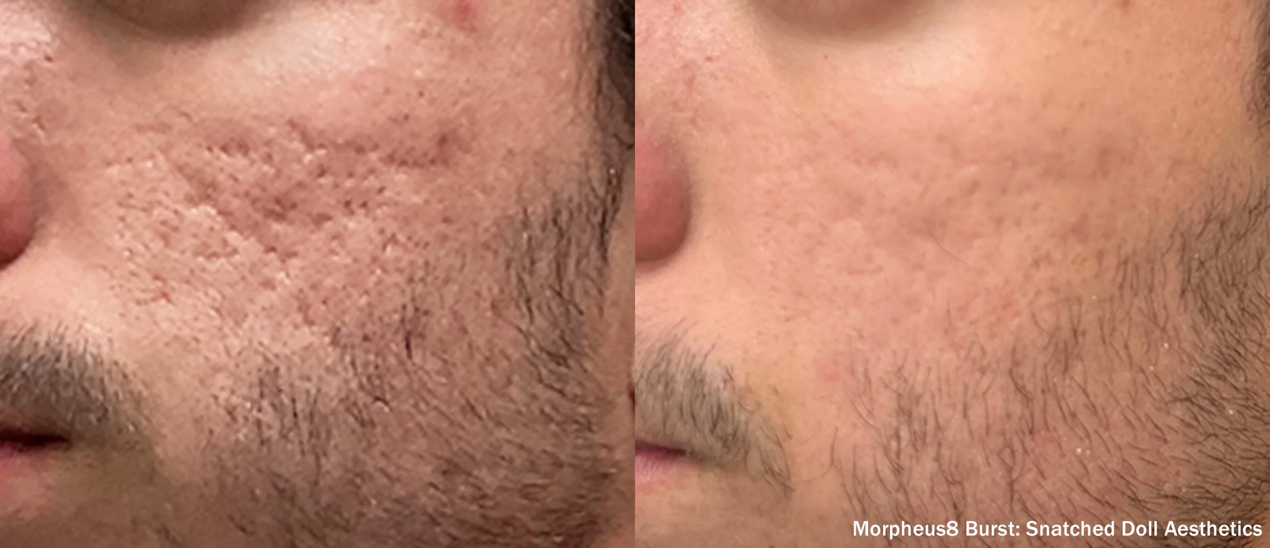 Photos courtesy of InMode.