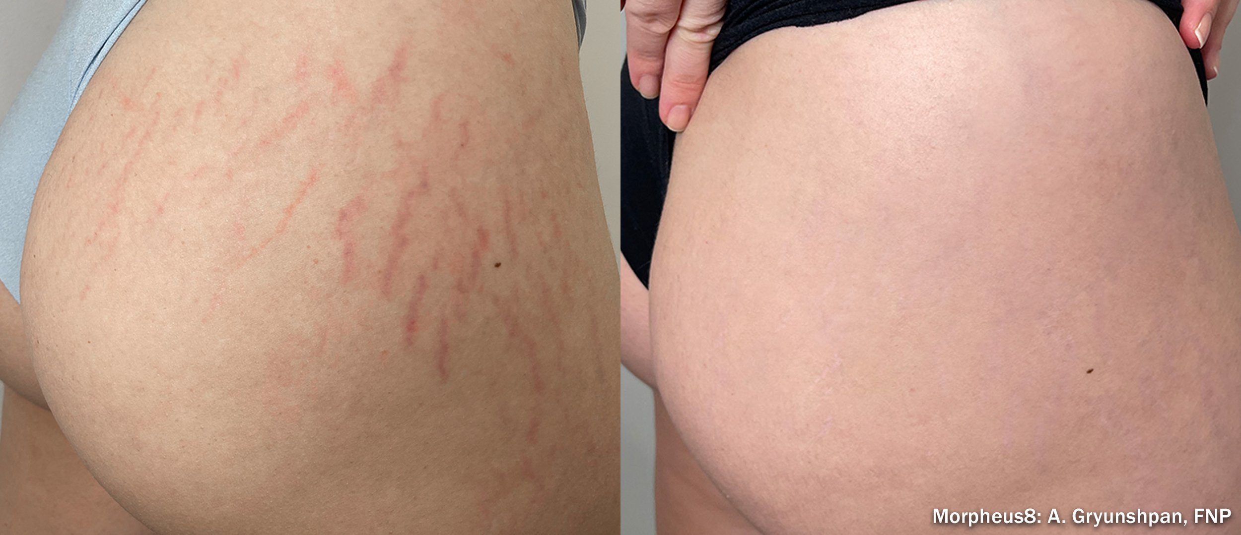 Photos courtesy of InMode.