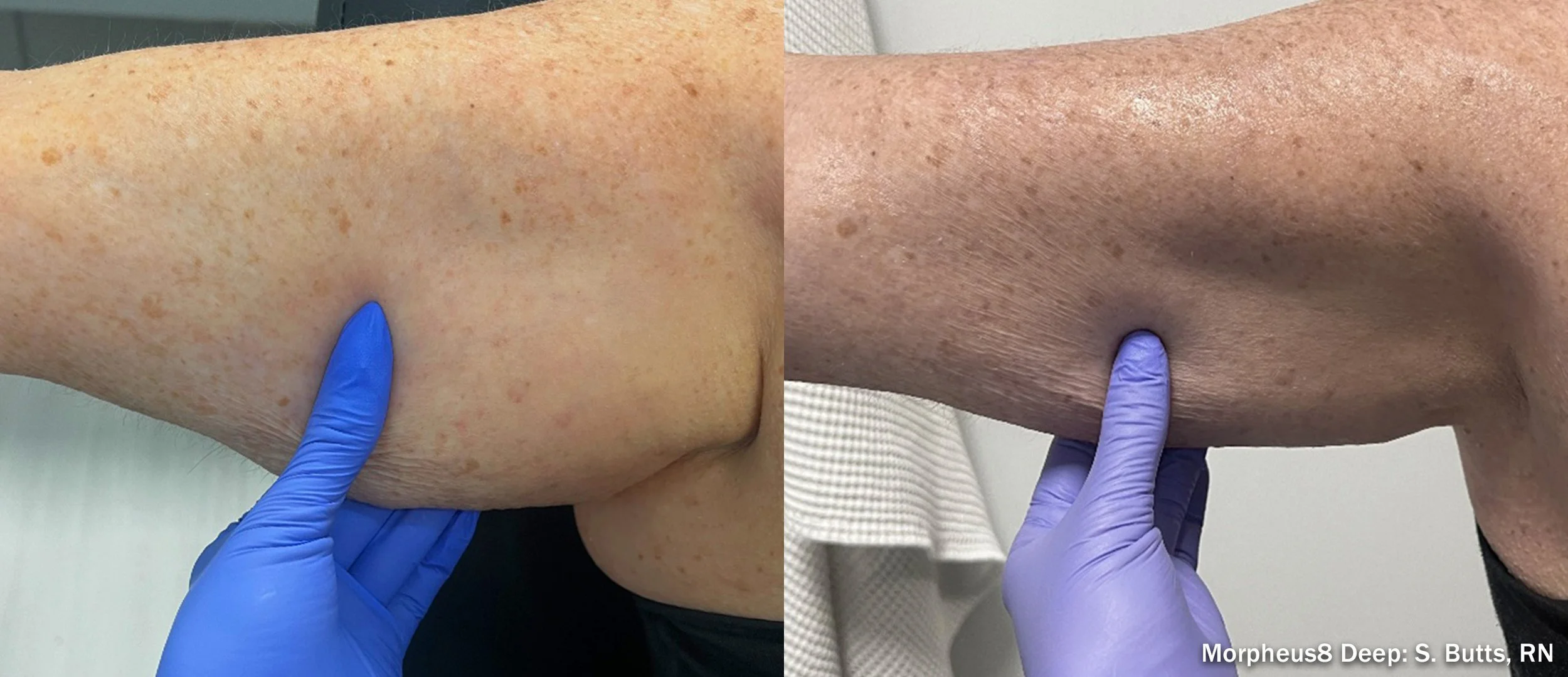 Photos courtesy of InMode.