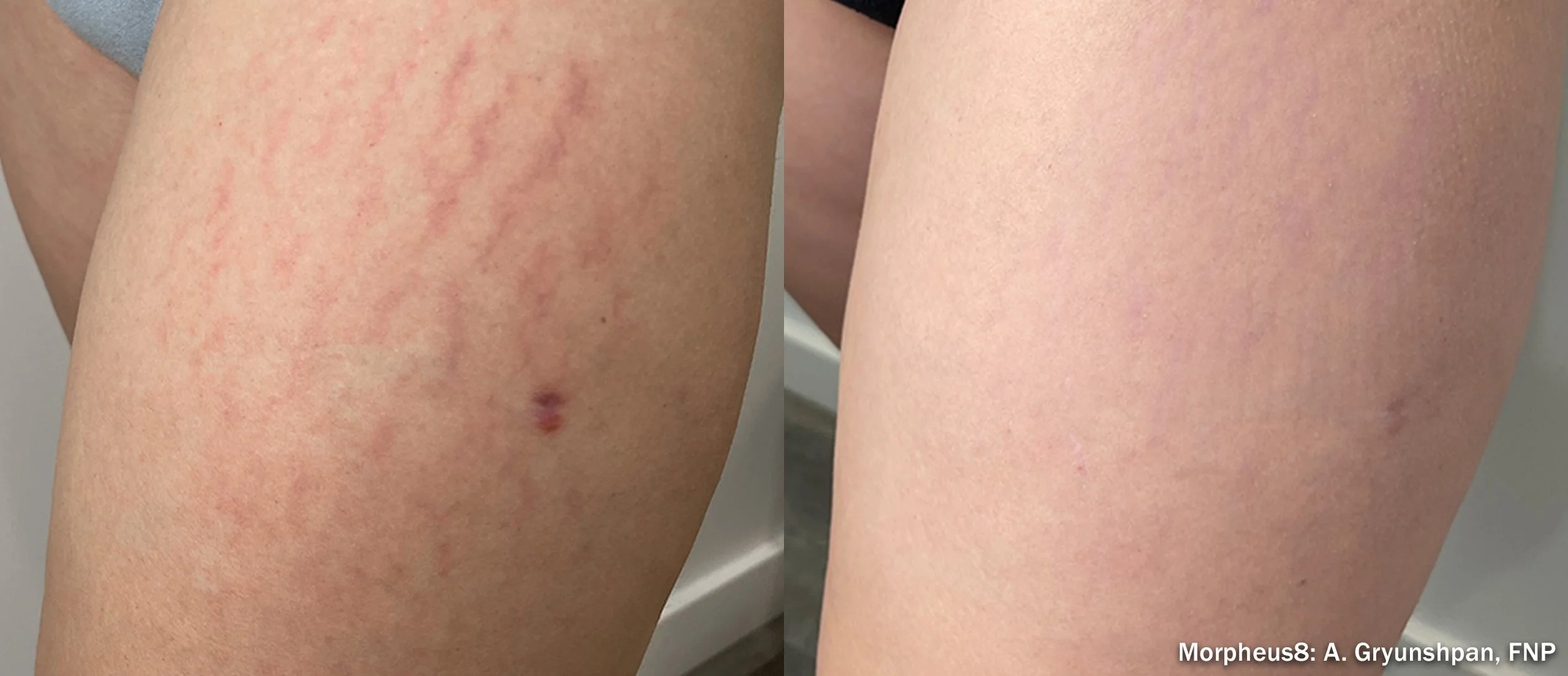 Photos courtesy of InMode.