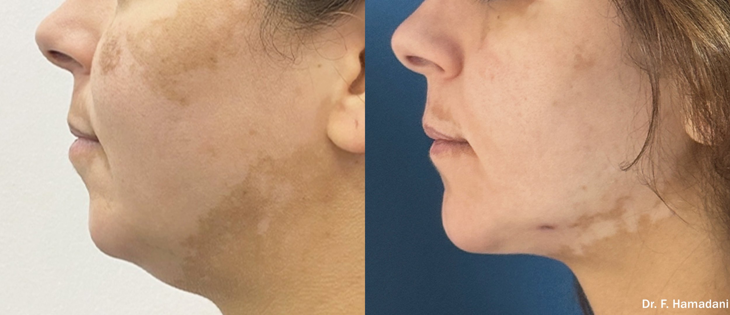 Photos courtesy of InMode.