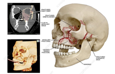 A Medic’s Guide to OMFS — JTG Online