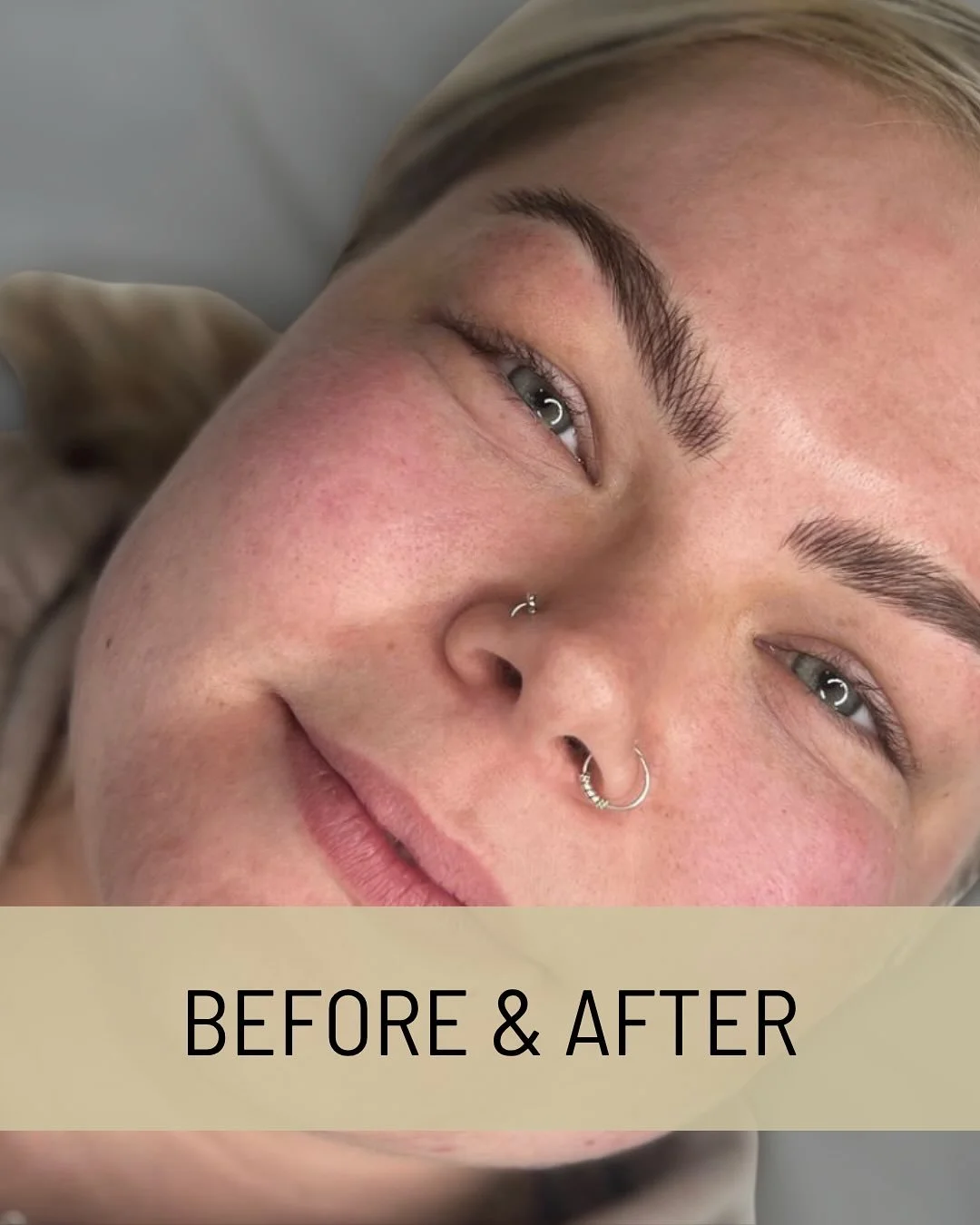 Interested to learn more about Brow Flex&rsquo;s nano brows? Swipe to see some before and afters&hellip;

Book via link in bio!

#NanoBrows #NanoBrowsBristol #BristolNanoBrows #PermanentMakeupBristol #PMUBristol #BristolPMU #BristolBeauty #NanoBrowAr