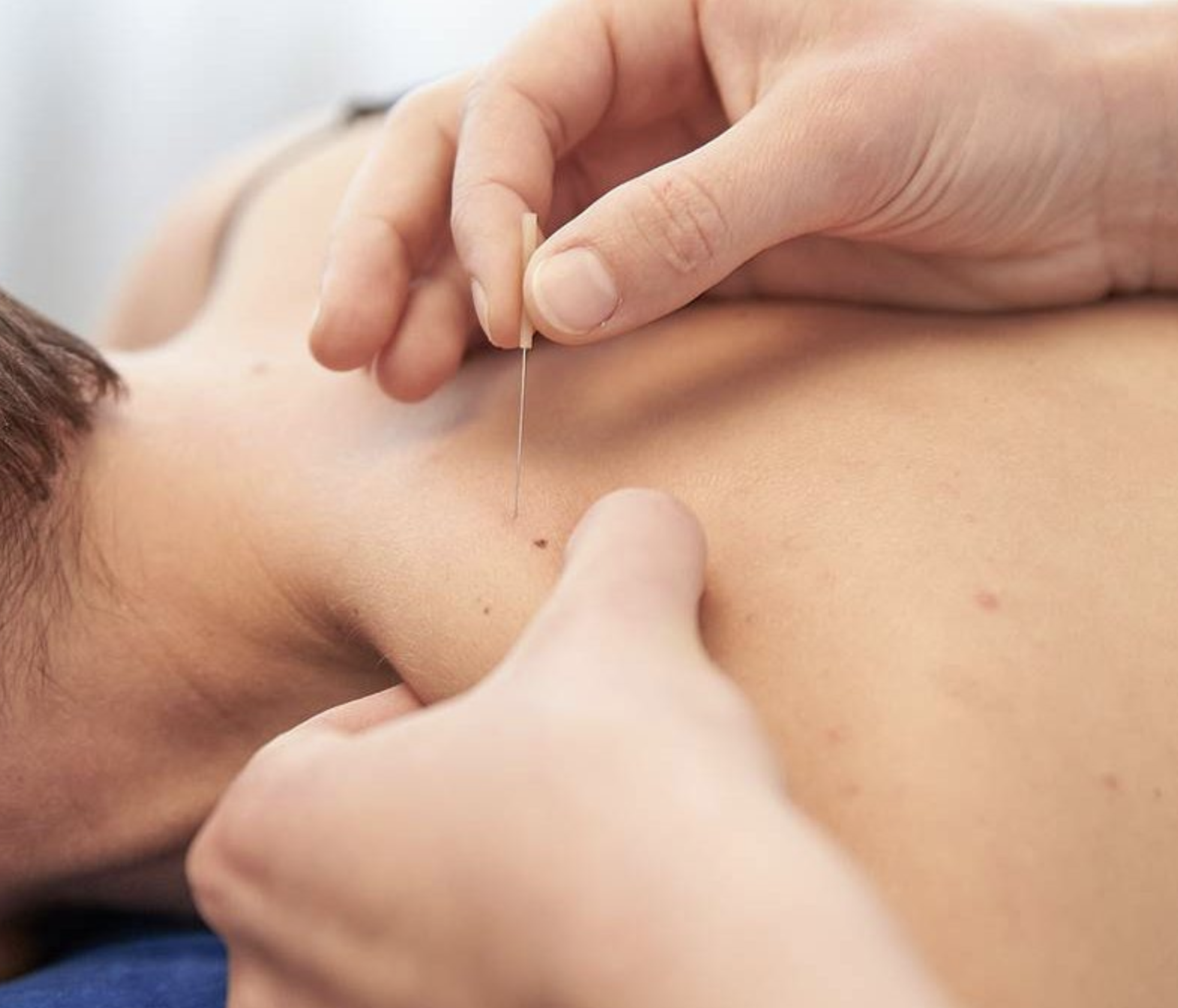 Medic legeert een naald in de huid van een persoon voor een prik.