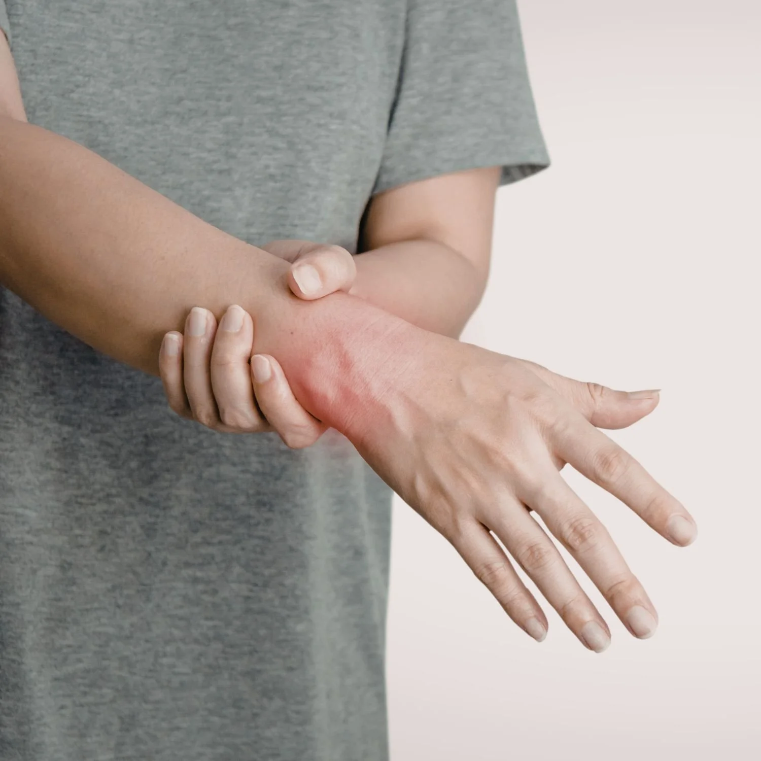 Person holding their elbow, which appears red and irritated.