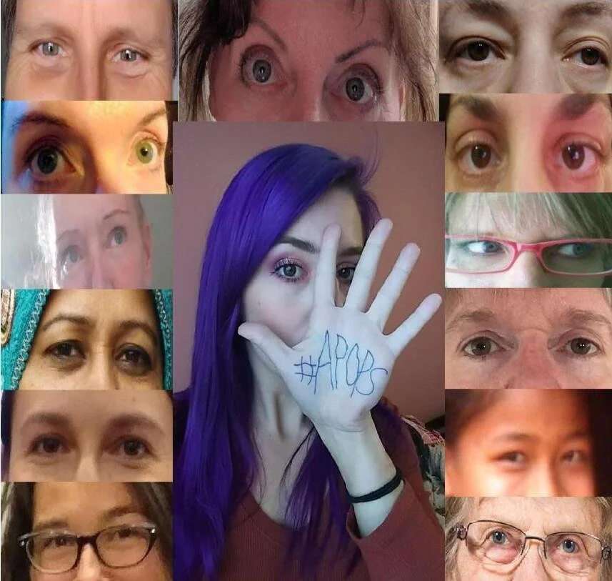 women with APOPS on hand.jpg