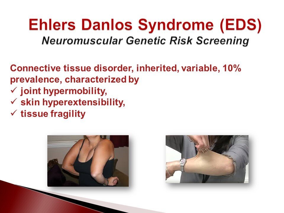 Ed's Dislocation POP and EDS Comorbidity | Key Women’s Health Insights APOPS ...