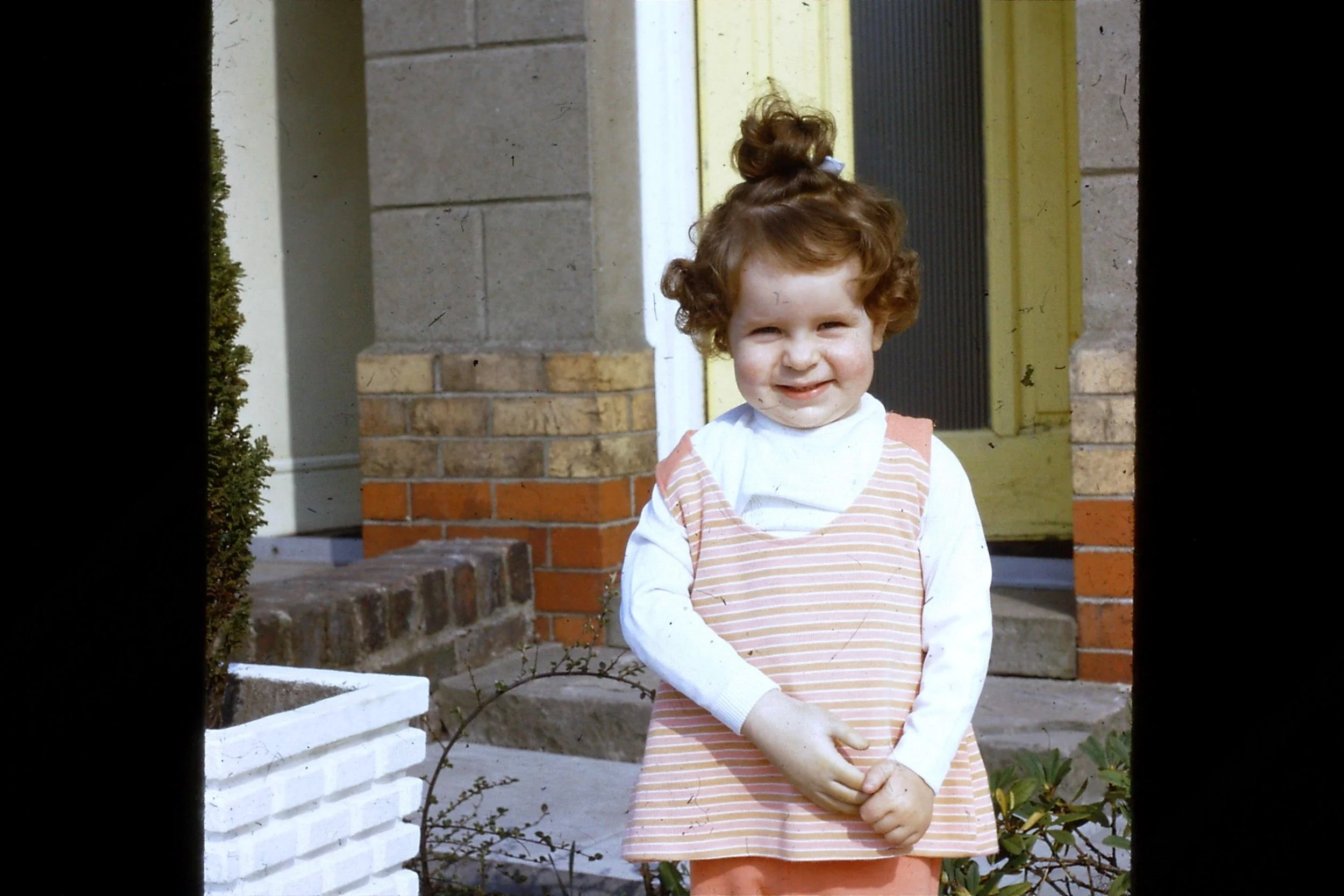 2 year old Sarah with her first prosthetic arm
