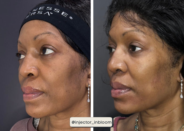 Copy of Solara B&A Template - Vertical (5).png