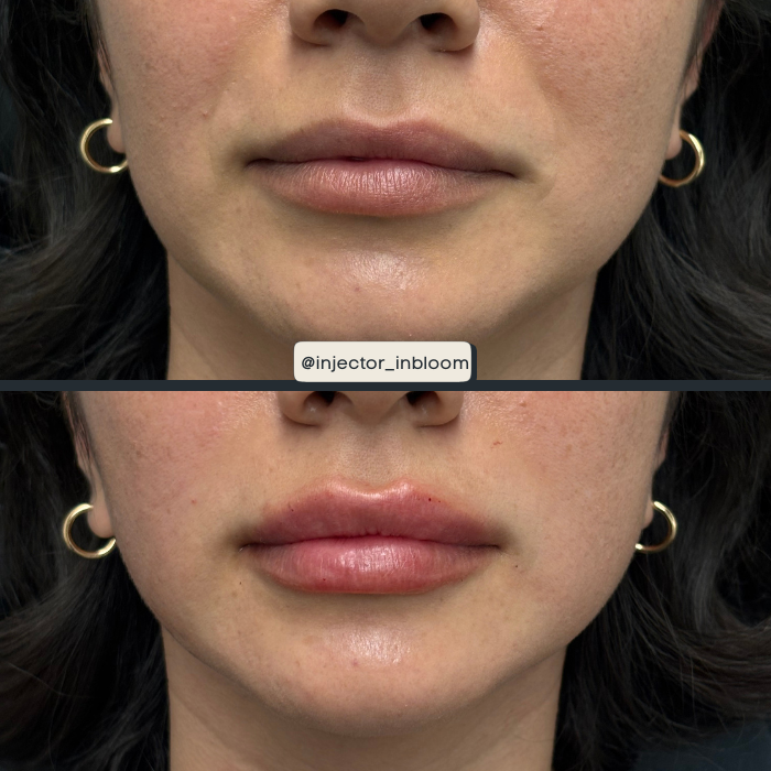 Copy of Solara B&A Template - Horizontal (6).png