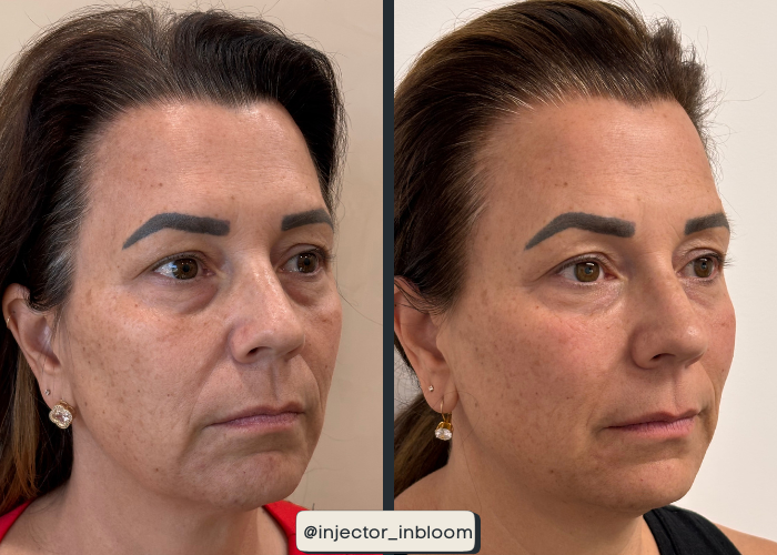 Copy of Solara B&A Template - Vertical (15).png