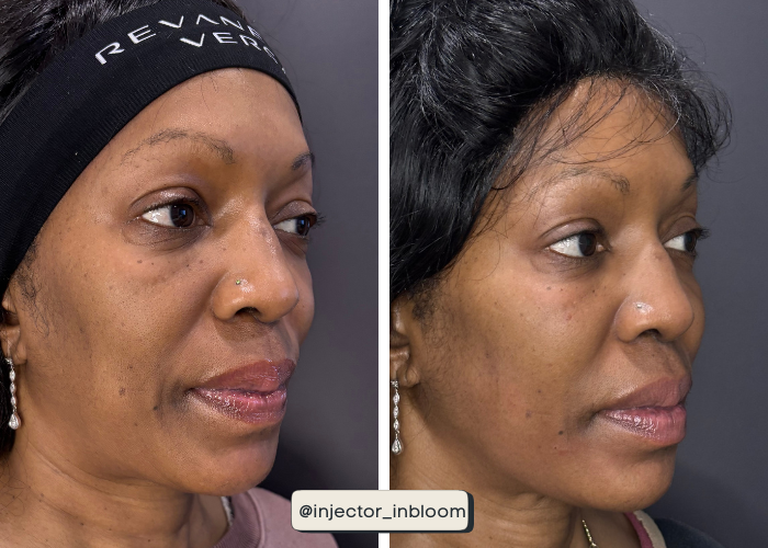 Copy of Solara B&A Template - Vertical (4).png