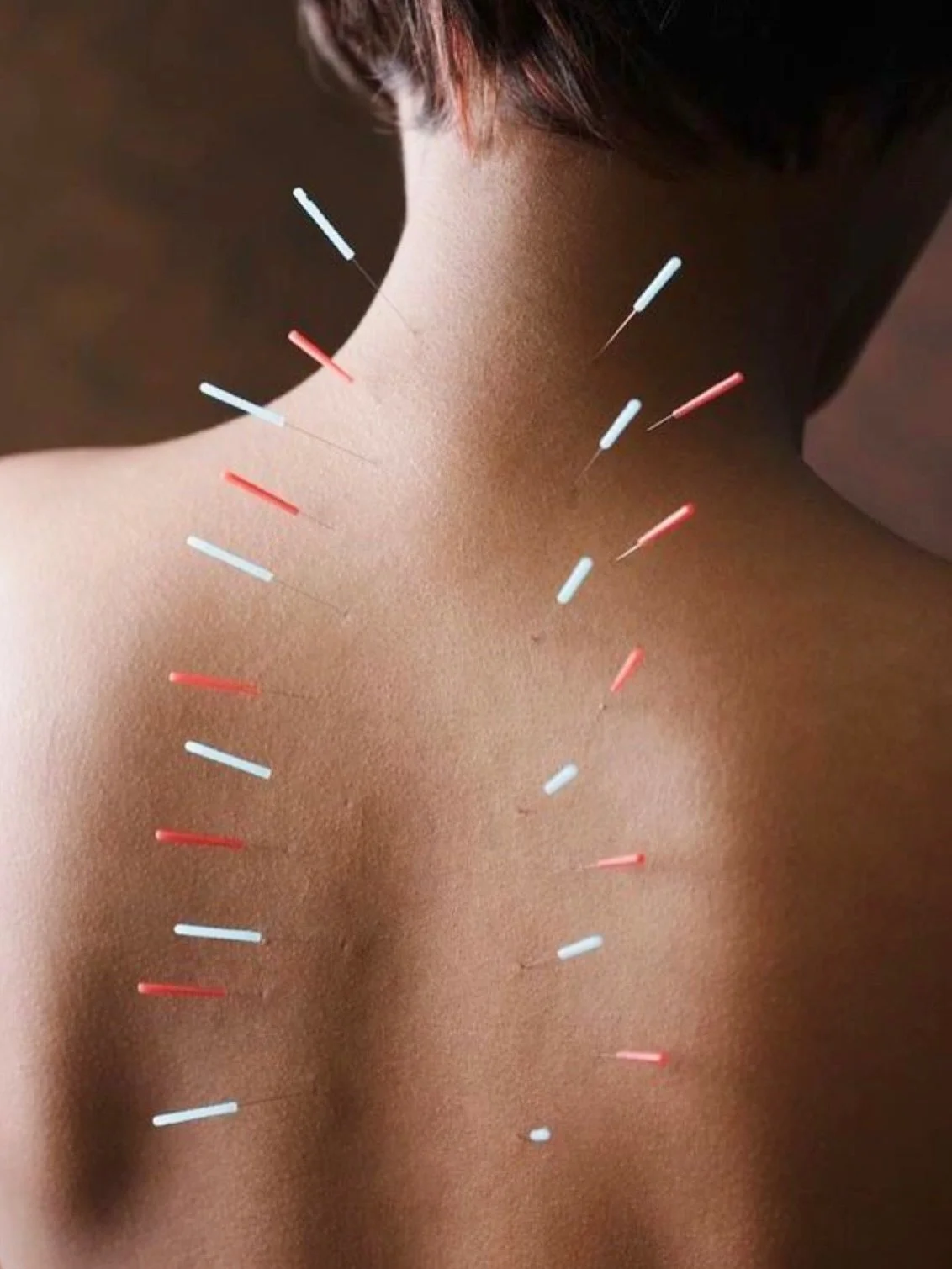 New to the g&amp;g treatment room! Meet Imogen from @innerseasonsacupuncture. 

Imogen is a qualified acupuncturist and the founder of Inner Seasons Acupuncture. She offers gentle, individualised acupuncture to support physical and emotional wellbein