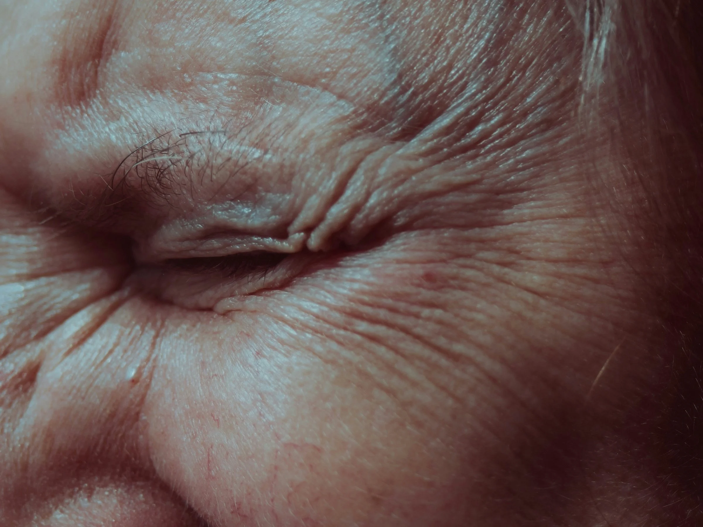 Close-up of a person's eye with wrinkles and slightly furrowed brow.