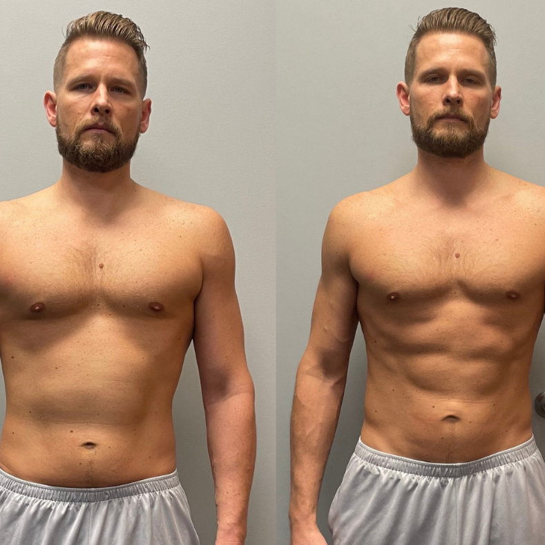 Peptide Guided Anti-Aging