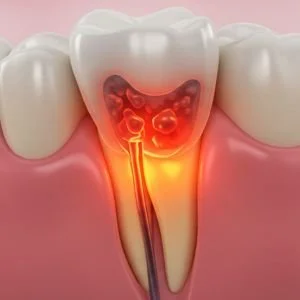 علاج ألم الأسنان في عيادة حياة دنت