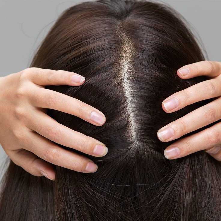زراعة الشعر للنساء في تركيا: استعيدي كثافة شعرك وجمالك الطبيعي