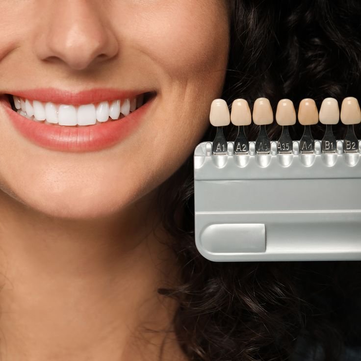 ابتسامة هوليود