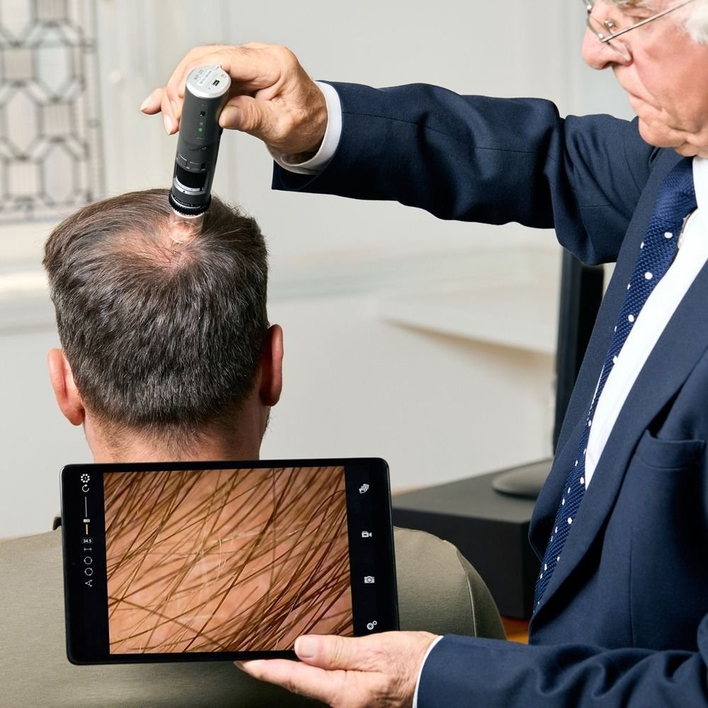 استخدام الذكاء الاصطناعي في تشخيص تساقط الشعر وزراعة الشعر