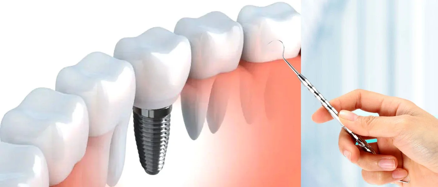 تركيا وجهتك المثالية لزراعة الأسنان