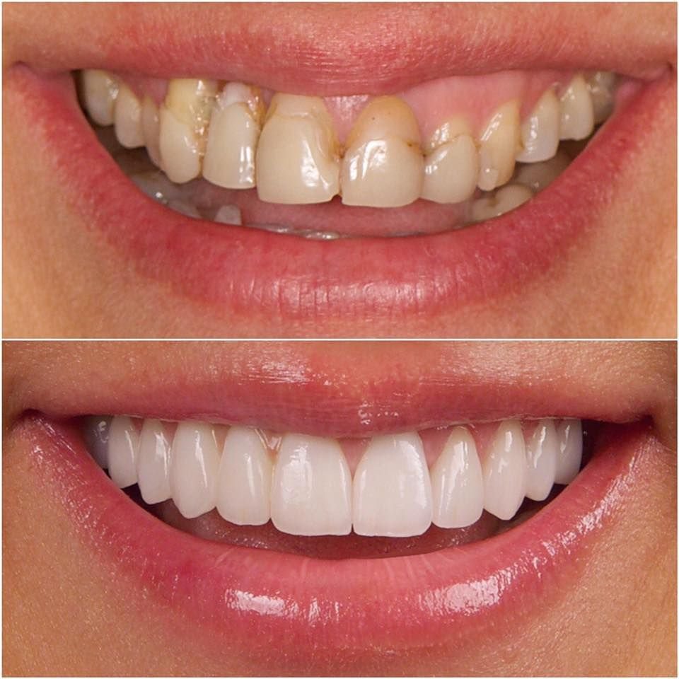 احصل على ابتسامة مثالية اليوم: أحدث تقنيات طب الأسنان بدون ألم
